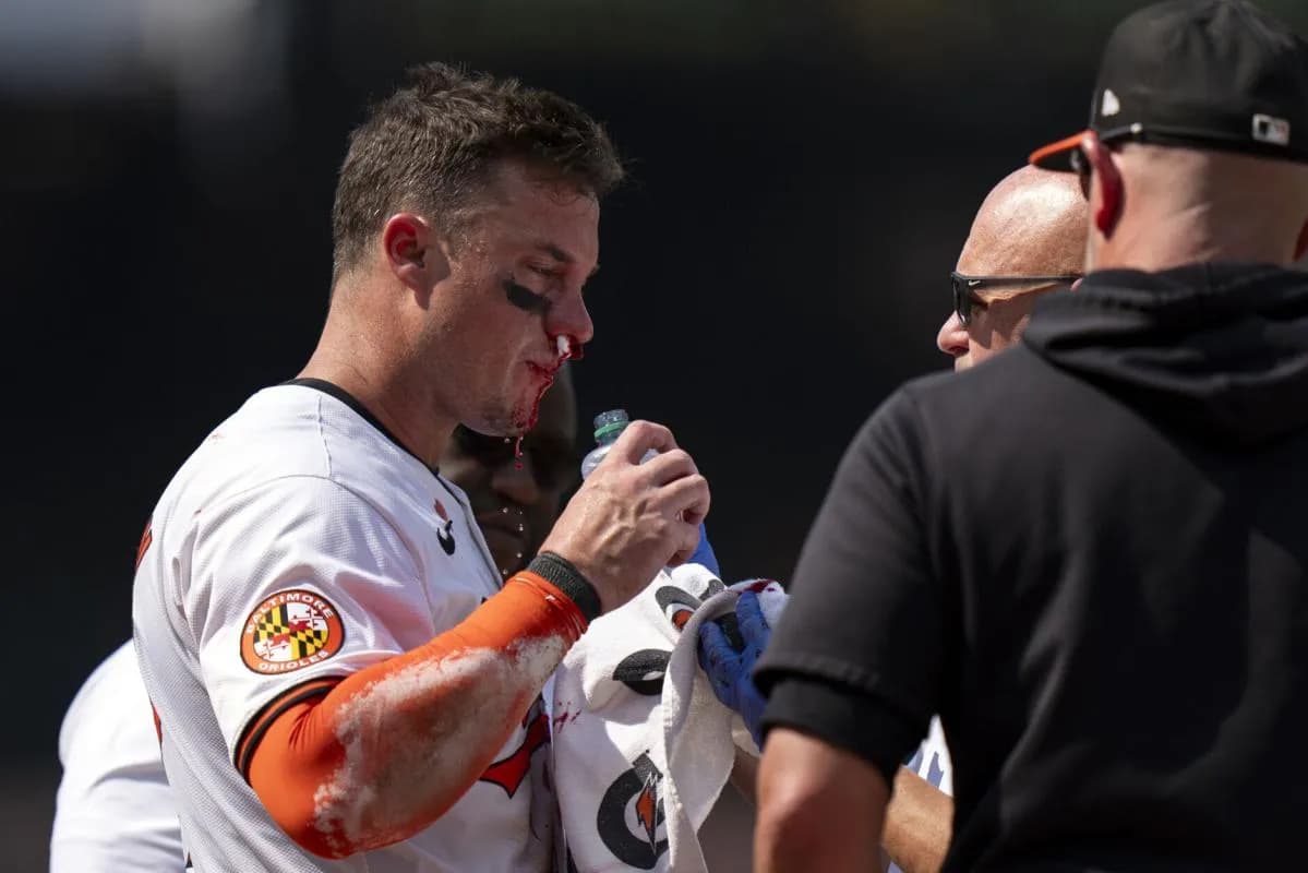 James McCann after getting hit in the face with a fastball against the Toronto Blue Jays.