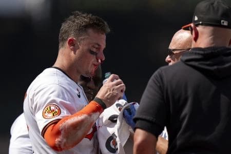 James McCann after getting hit in the face with a fastball against the Toronto Blue Jays.